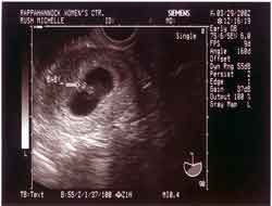 Click for larger image of sonogram